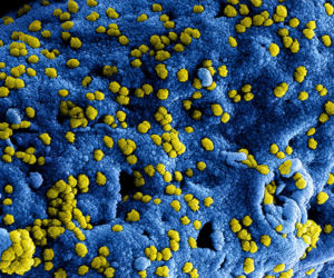 MERS