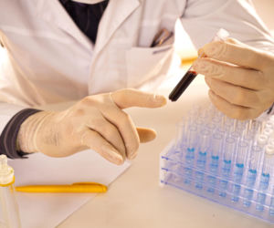 Niewinne obrzęki często pojawiają się przed diagnozą choroby nerek. Jeden wskaźnik ujawnia skalę problemu