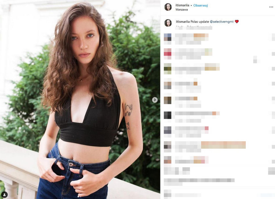 Koszmarny wypadek pięknej modelki. Jej twarz i ręce niemal spłonęły. Wieniawa apeluje o pomoc