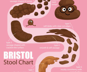 Bristolska skala uformowania stolca