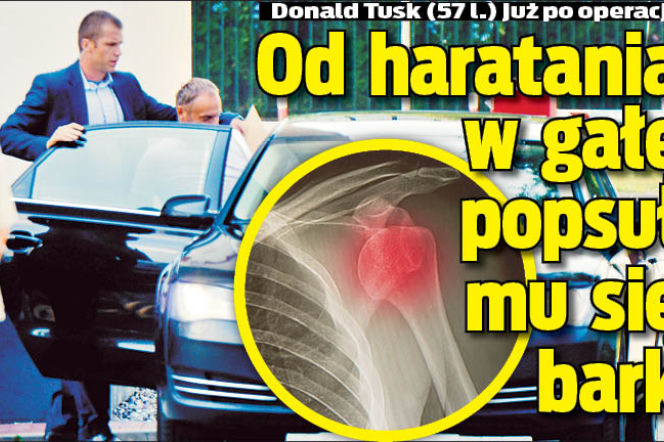 Od haratania w gałę popsuł mu się bark