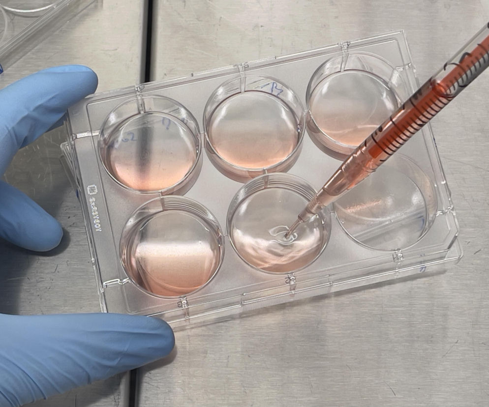 Ręka badacza w niebieskiej rękawiczce zakrapla płyn do płytki laboratoryjnej. O regeneracji mięśni przeczytasz na PZ.