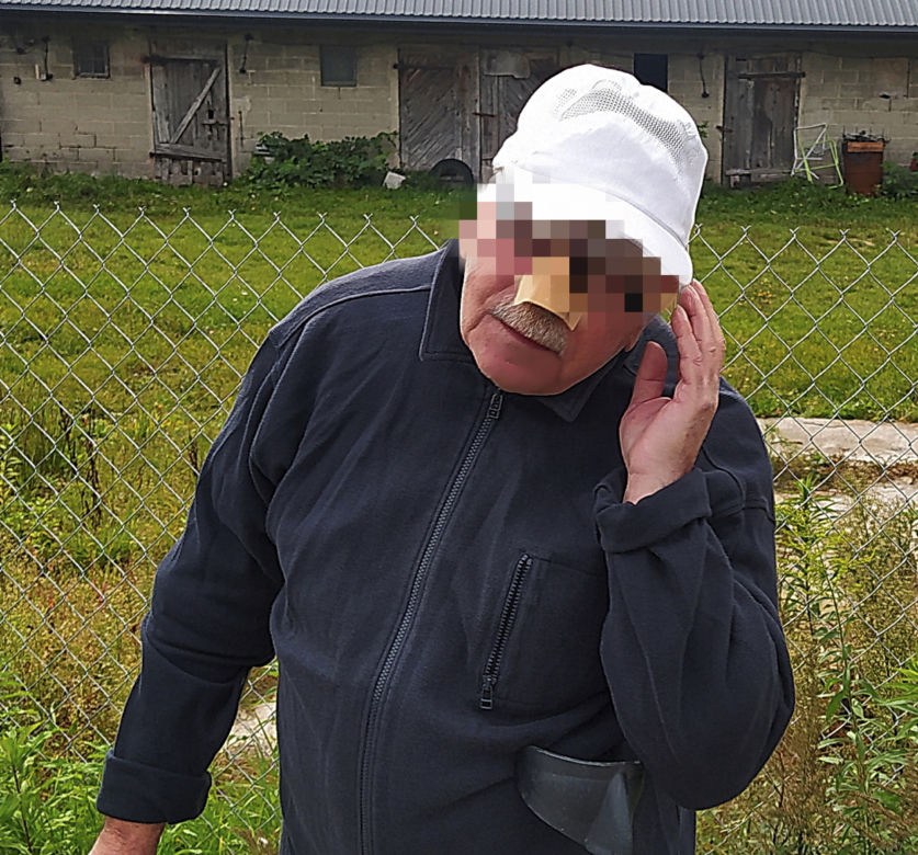 Krwawa przygoda gospodarza z Mazowsza. Krowa Baśka zjadła mu nos