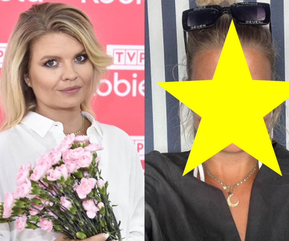 Co się stało z twarzą Marty Manowskiej? Duża zmiana!