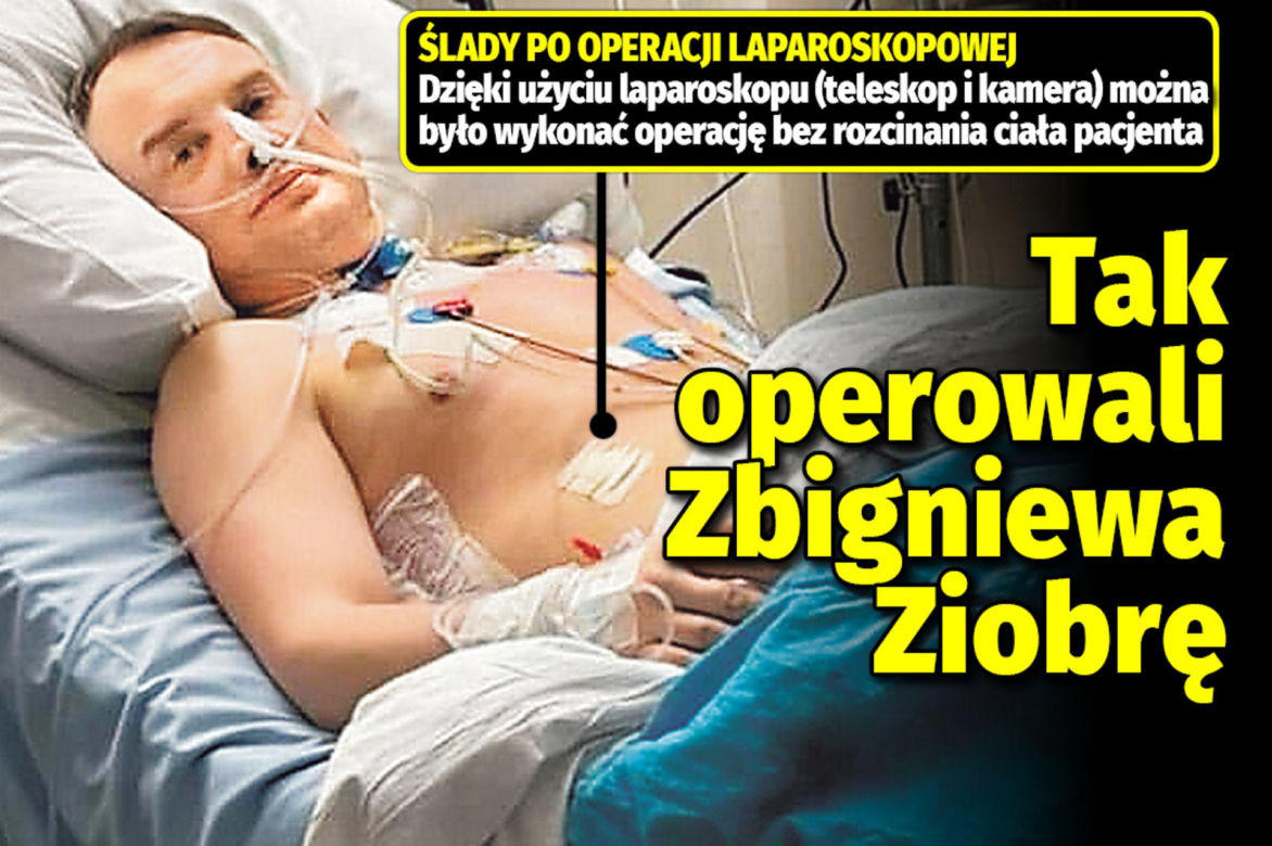 Tak operowali Zbigniewa Ziobrę