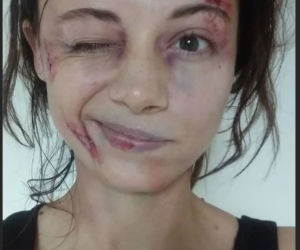 M jak miłość. Adriana Kalska (Iza Lewińska) pobita