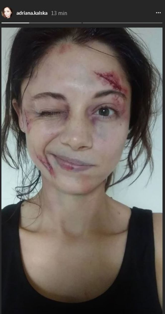 M jak miłość. Adriana Kalska (Iza Lewińska) pobita