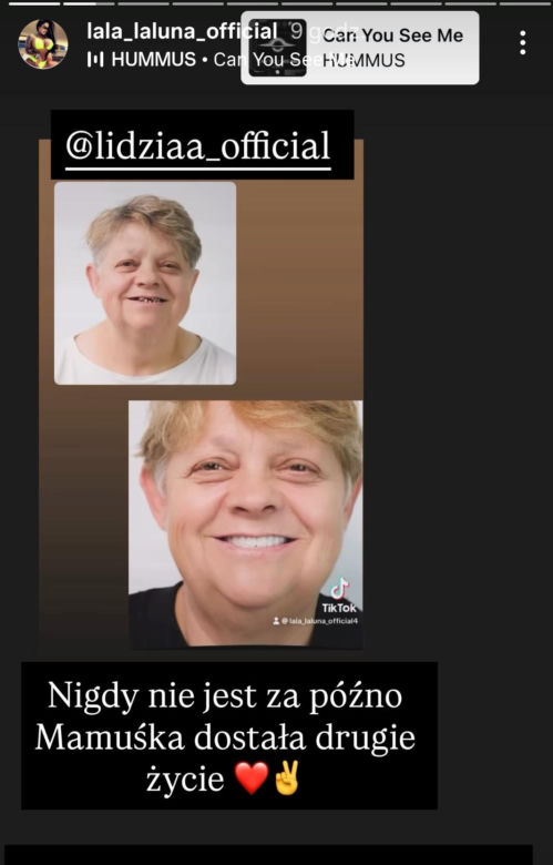 Laluna sprawiła mamie nowe zęby. "Dałaś mi drugie życie"