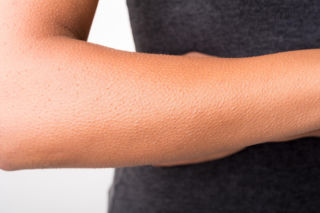 Gęsia skórka to nie tylko reakcja na zimno. Może zdradzać kluczową cechę twojej osobowości