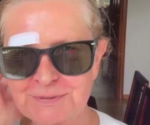Barbara Busztynowicz miała wypadek! Skończyło się szyciem. Nikt się nie zatrzymał