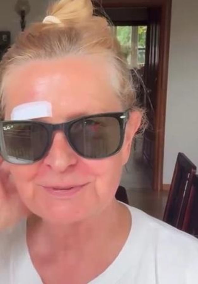 Barbara Busztynowicz miała wypadek! Skończyło się szyciem. "Nikt się nie zatrzymał"