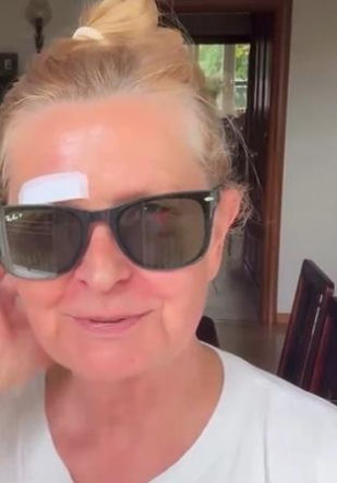 Barbara Busztynowicz miała wypadek! Skończyło się szyciem. "Nikt się nie zatrzymał"