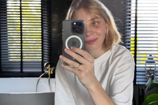 Kamila Sellier po rekonstrukcji oczodołu