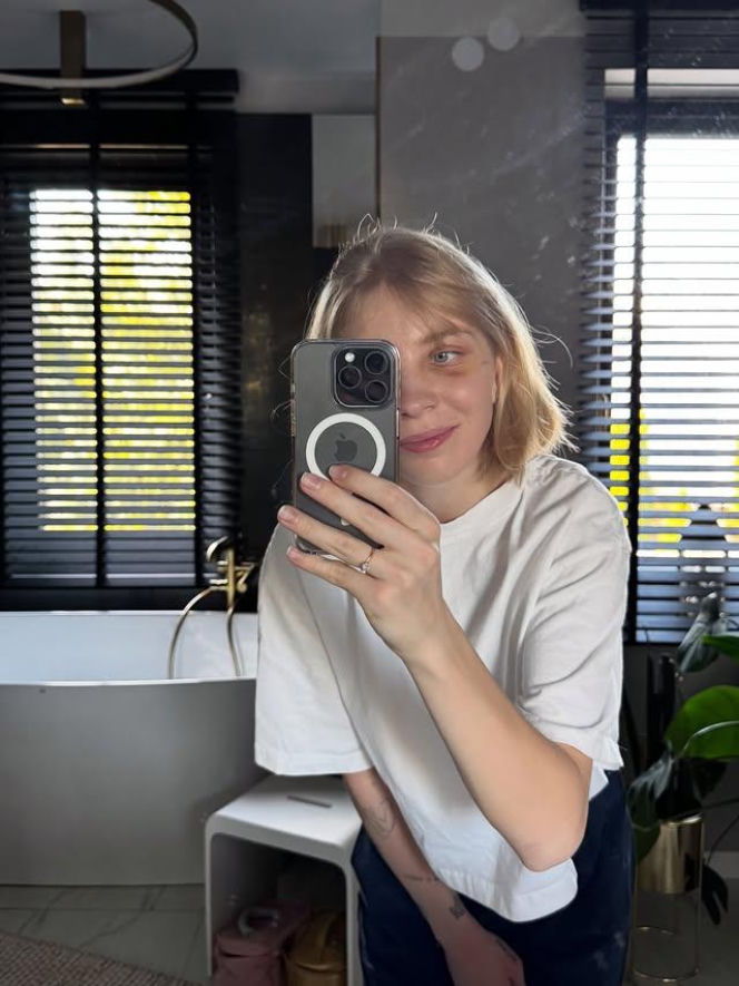 Kamila Sellier po rekonstrukcji oczodołu