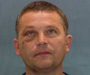 Wydrukowali mu nowe kości twarzy