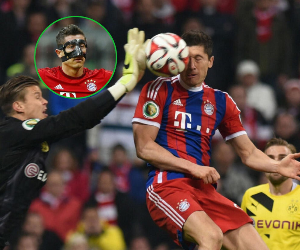 Robert Lewandowski kontuzjowany. Kiedyś przeżył gorsze starcie