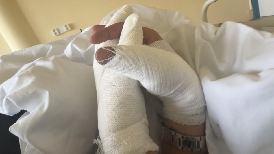 Koszmarny wypadek pięknej modelki. Jej twarz i ręce niemal spłonęły. Wieniawa apeluje o pomoc