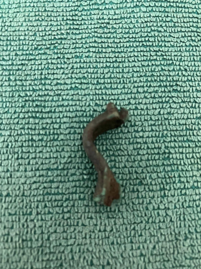 Pasjonaci historii znaleźli skarby sprzed 2 tysięcy lat