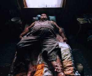 Taksówkarz i aktor z „Pitbulla” w szpitalu. Walczy o powrót do zdrowia. „Ludzie umierali obok mnie”