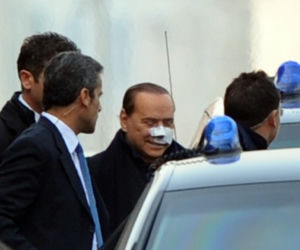 Berlusconi w opatrunkach 