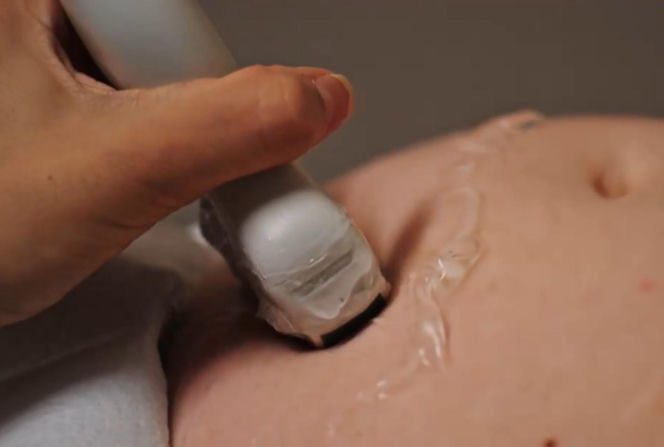 Złoty chłopak odcinek 277