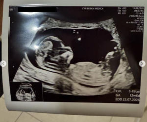 Areta Szpura-Rylska, Agnieszka Szpura-Rylska