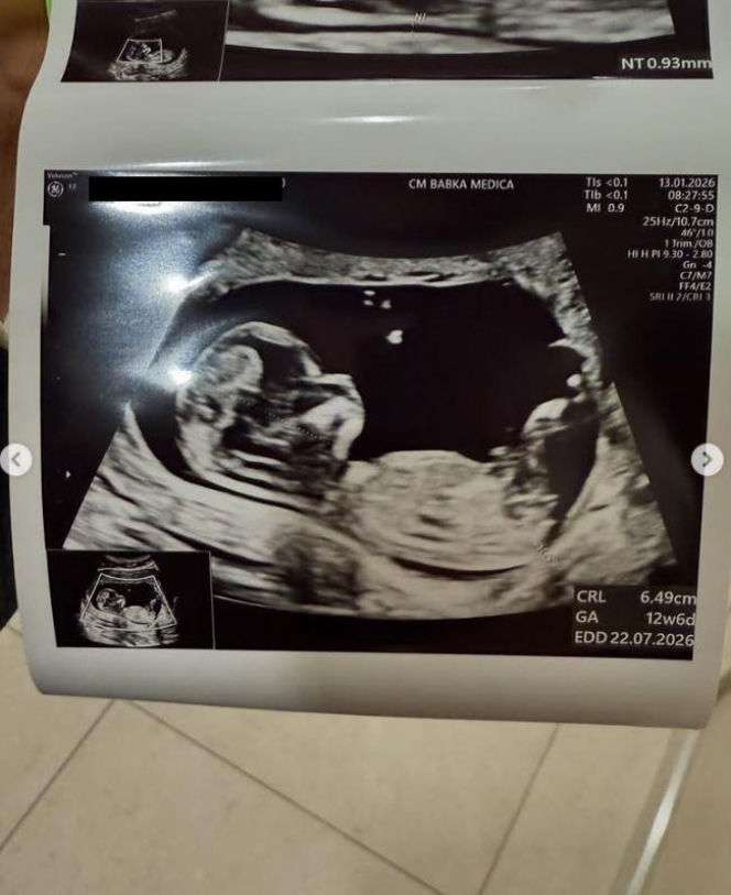 Areta Szpura-Rylska, Agnieszka Szpura-Rylska