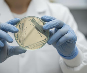 Wyspy Zielonego Przylądka ostrzegają. Jaka groźna choroba zbiera żniwo wśród Europejczyków?