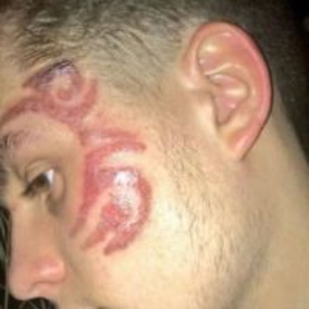 Tatuaże z henny mogą zostawiać blizny! [FOTO]
