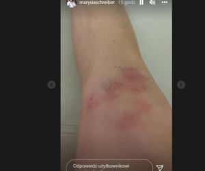 Marianna Schreiber szalała z piłką na boisku. Chwila nieuwagi i znalazła się na SOR!
