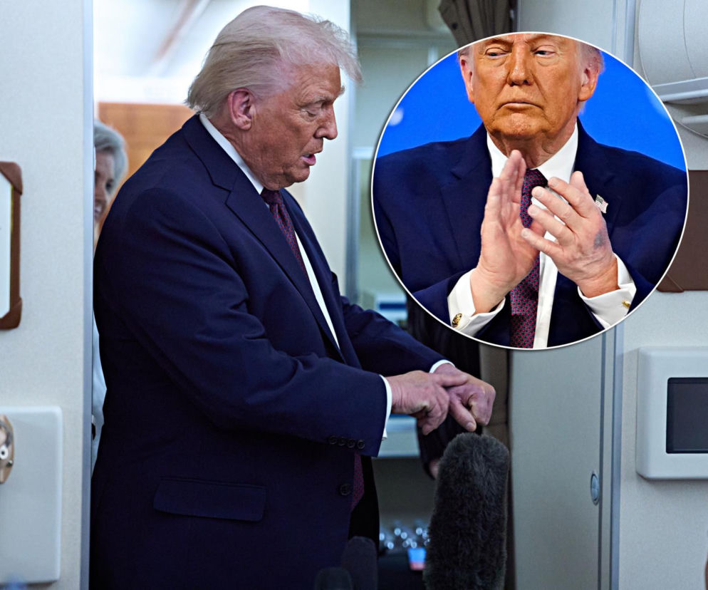 Tajemniczy znak na ręce Trumpa! Rzeczniczka tłumaczy