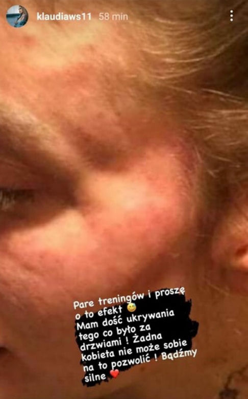 Klaudia z "Warsaw shore" pobita przez partnera?!