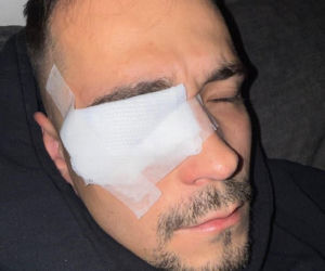 Polski influencer miał wypadek. Ucierpiało jego oko