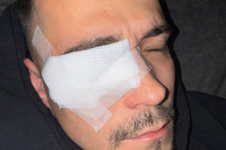 Polski influencer miał wypadek. Ucierpiało jego oko