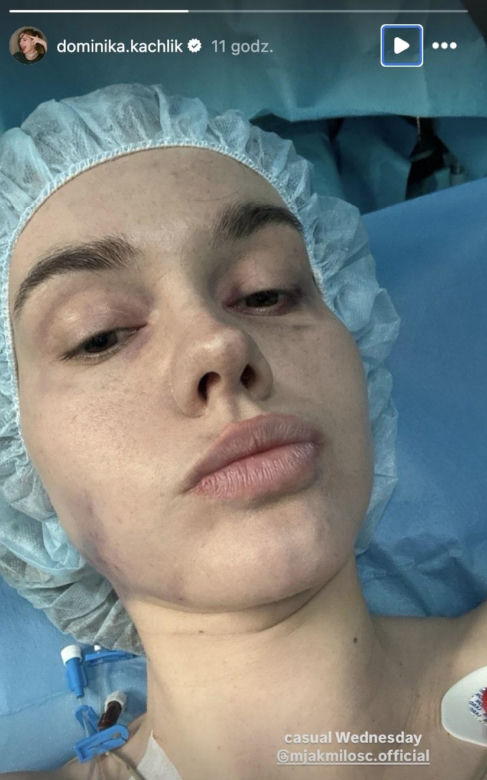 M jak miłość po wakacjach. Franka (Dominika Kachlik)