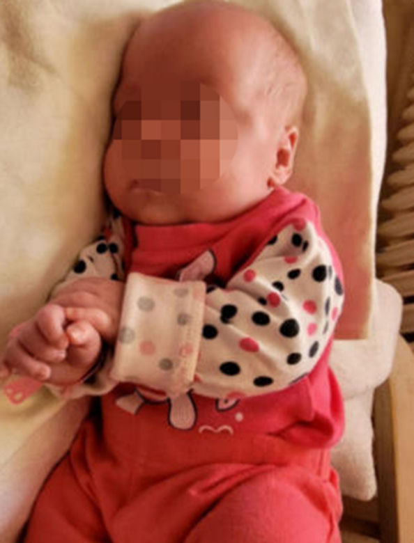Siostry rozdzielone tuż po porodzie. Lekarze nie mieli innego wyjścia. Rodzice dziewczynek nie chcą się poddać [ZDJĘCIA]
