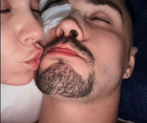 Polski influencer miał wypadek. Ucierpiało jego oko