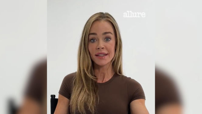Denise Richards i jej lifting twarzy szokują. Aktorka się tłumaczy i pokazuje nagranie z zabiegu