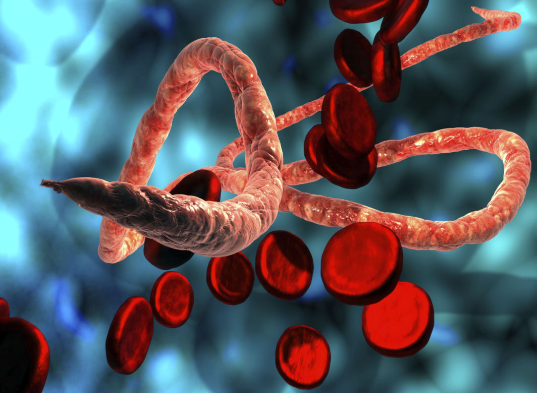 Gorączka krwotoczna ebola