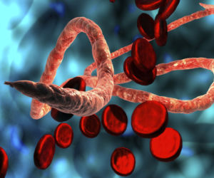 Gorączka krwotoczna ebola