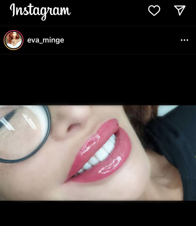 Ewa Minge znowu zrobiła usta