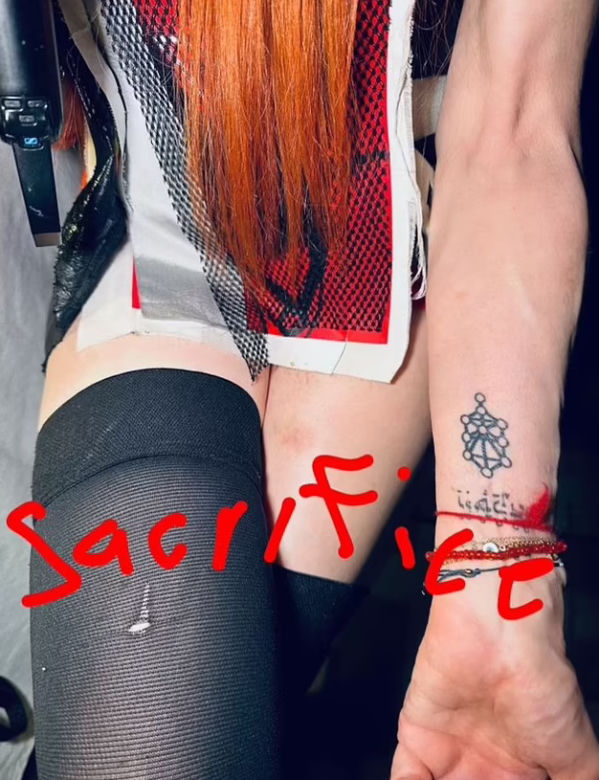 64-letnia Madonna bez majtek i cała w siniakach. Fani przerażeni!