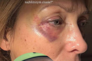 Pechowe ferie gwiazd