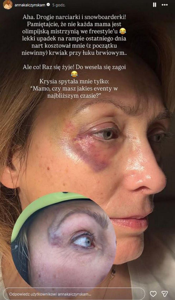 Pechowe ferie gwiazd