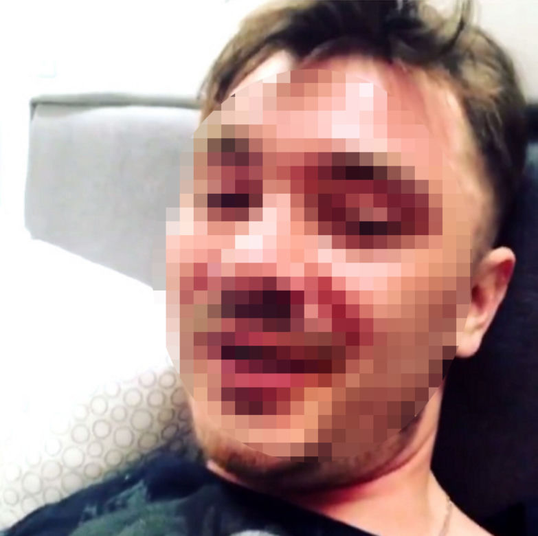 Syn Zenka dostał gazem w twarz