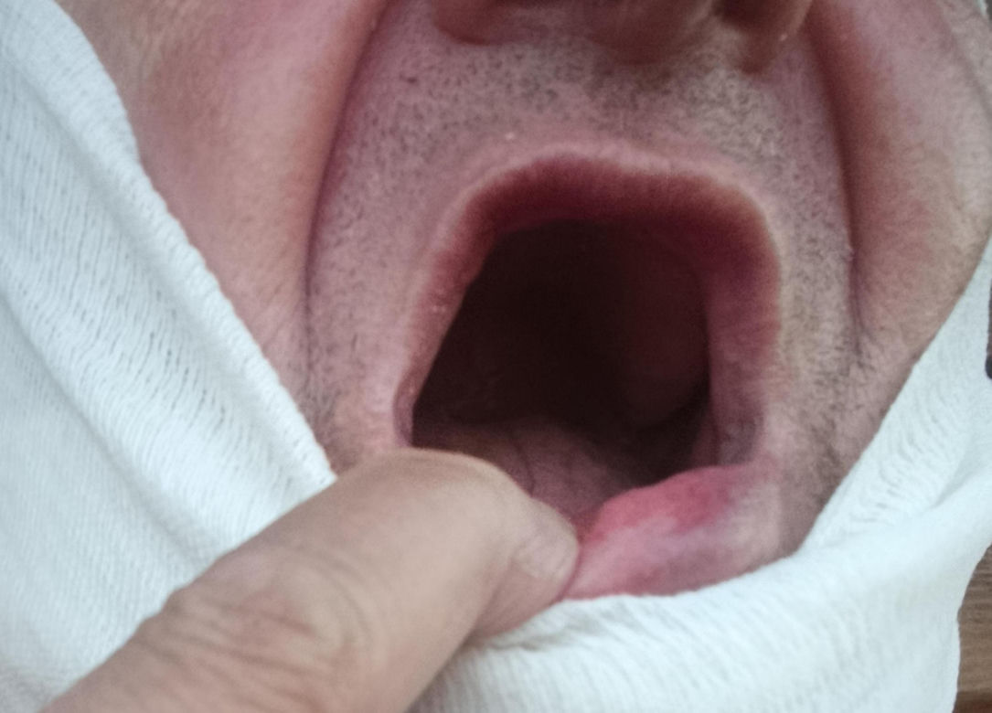 Zabił muchę na klaczy, Klara krwawo się zemściła: "Stachu stracił siedem zębów i lewe oko"