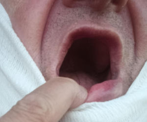 Zabił muchę na klaczy, Klara krwawo się zemściła: Stachu stracił siedem zębów i lewe oko