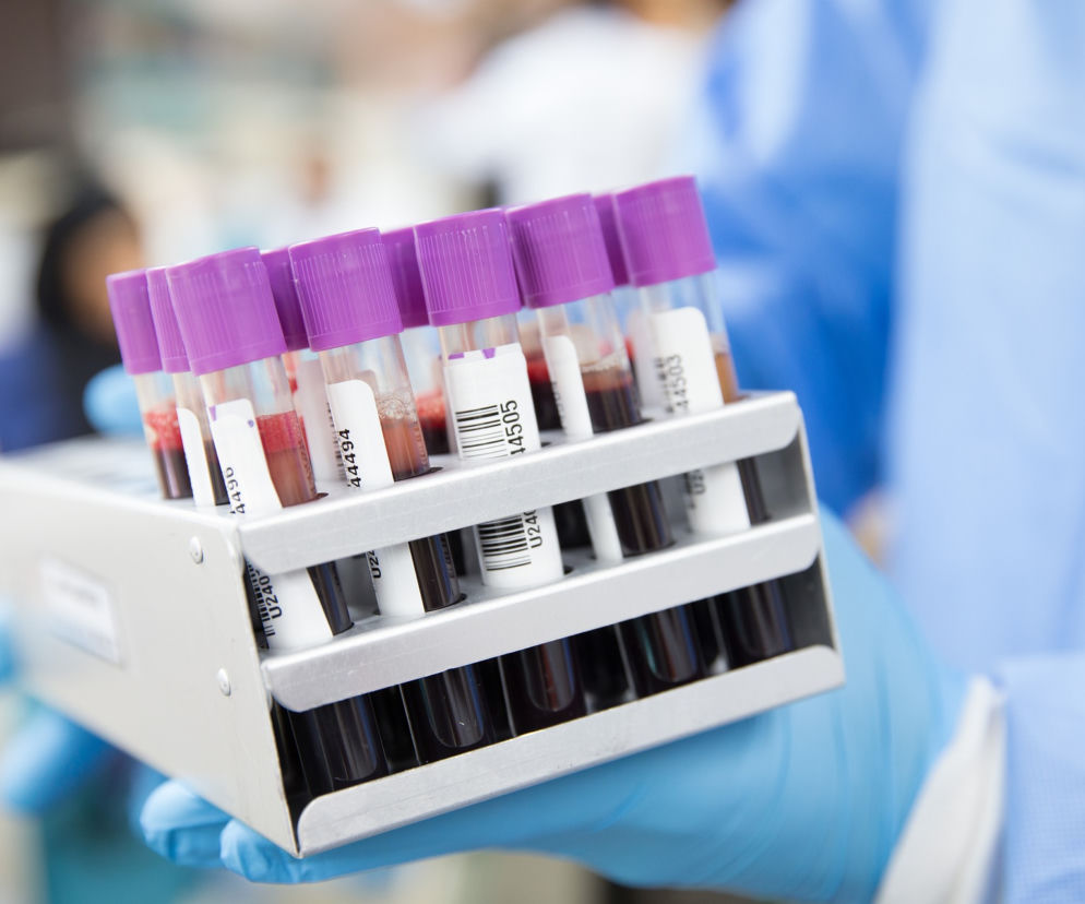 Wrocław: Biobank szuka dawców materiału biologicznego