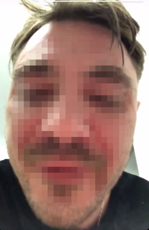 Syn Zenka dostał gazem w twarz