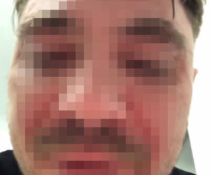 Syn Zenka dostał gazem w twarz